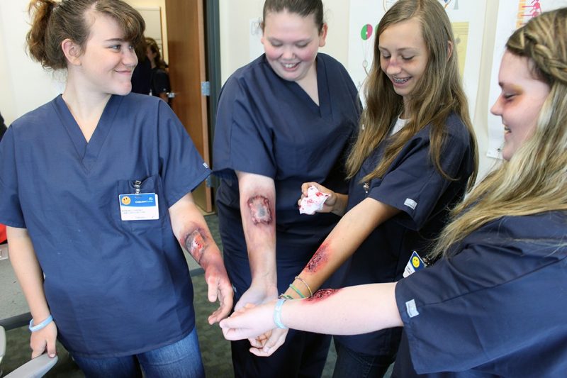  Four campers from Camp Carilion show off their moulage work, including burns, black eyes, and gashes.