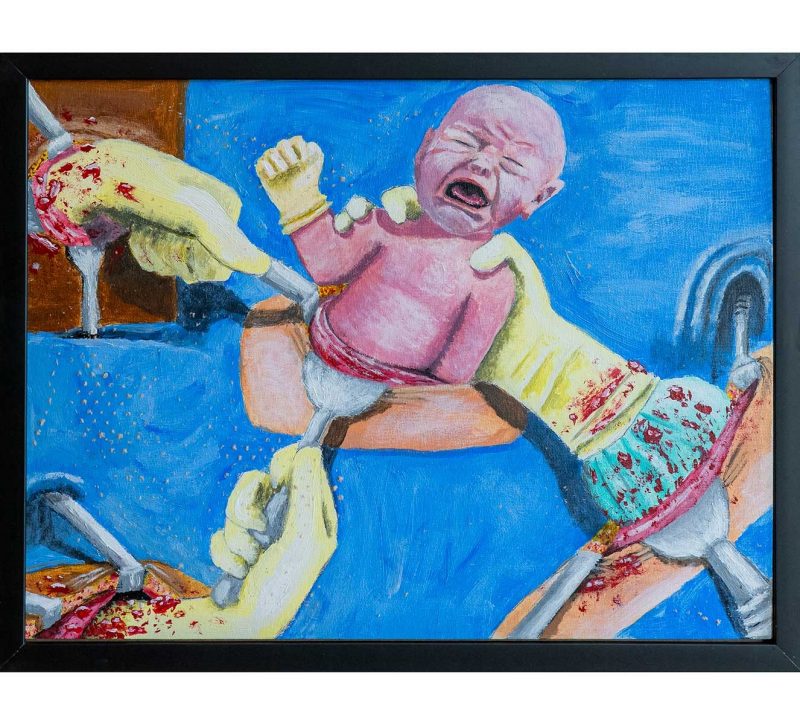 a blue background with a baby in the center with three hands and instruments coming in from various sides